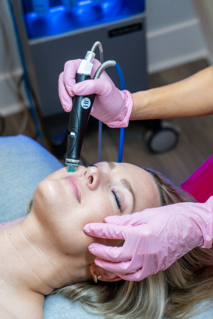 HydraFacial treatment being performed at Skin Social med spa Sandy Springs GA