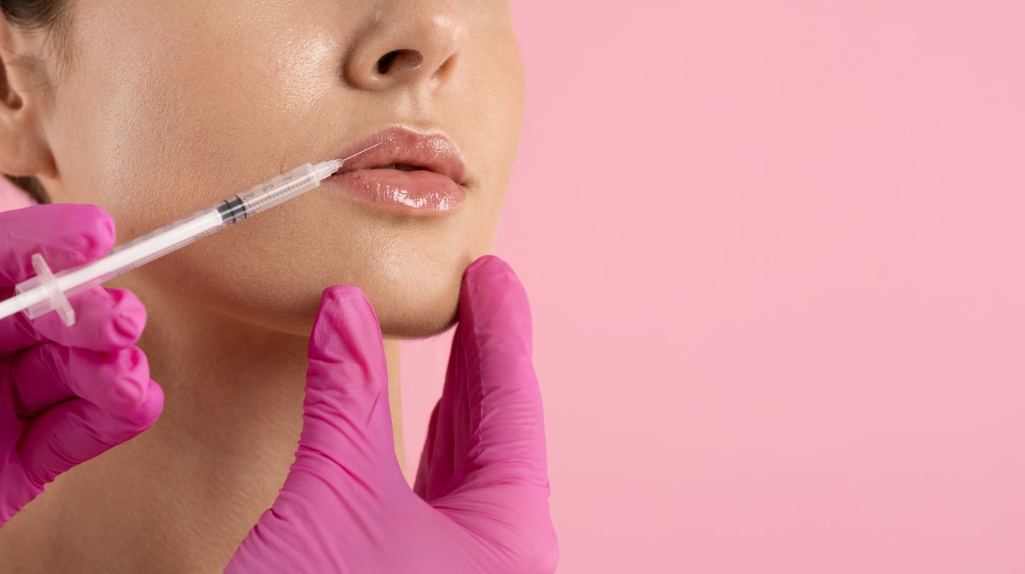 woman receiving hyaluronic acid lip filler injection with syringe