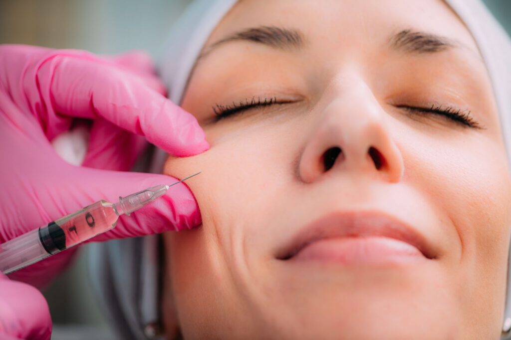 dermal filler injection in the cheek with hyperdilute Radiesse