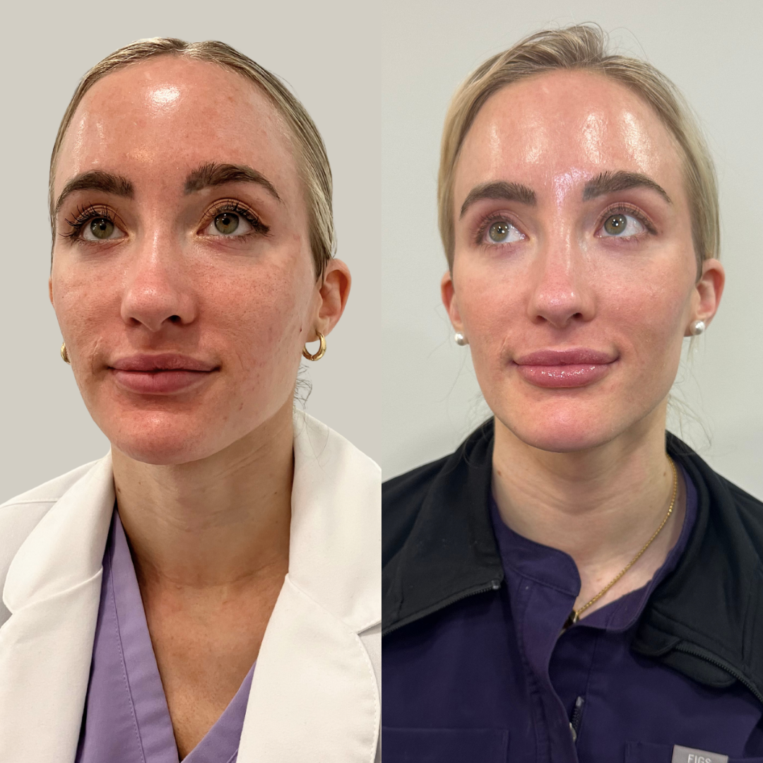 ZO Glass Facial – Case 1